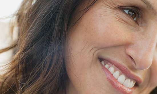 DYSPORT® Cosmetic Wrinkle Treatment - Crow's Feet