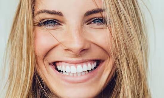 GO SMILE™ Teeth Whitening Treatment
