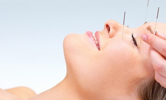 Acupuncture