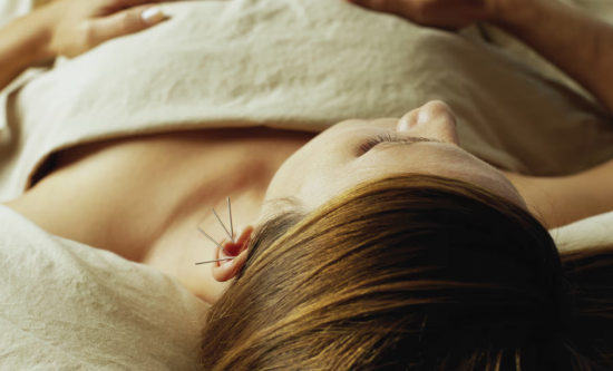 Traditional Chinese Acupuncture - 1 session