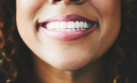 Restylane® Lip Lines Treatment