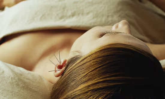 Traditional Chinese Acupuncture - 1 session
