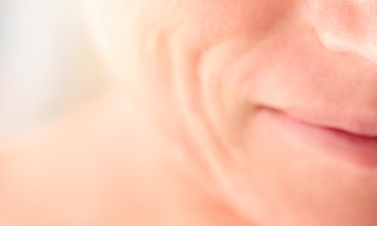 Restylane® Marionette Lines Treatment